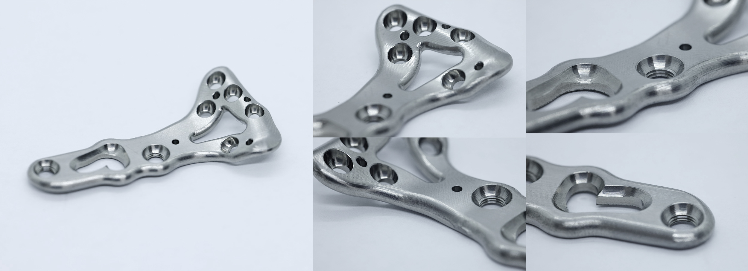 Volar Distal Plates